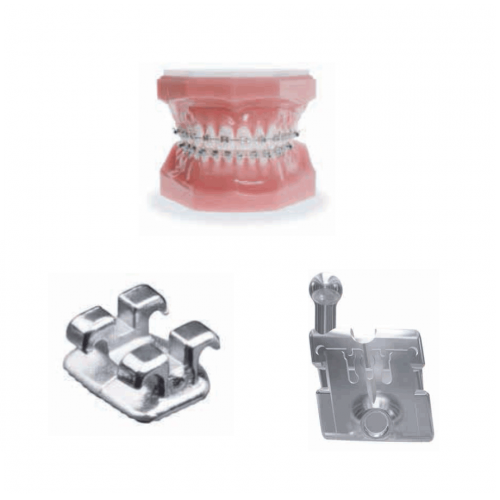 Orthodontic